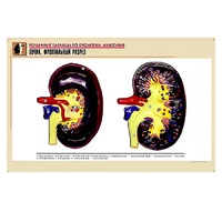 Рельефная таблица "Почка. Фронтальный разрез" (формат А1, матовое ламинир.) - «globural.ru» - Барнаул